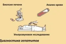 Гепатит Д як передається, симптоми та лікування Може