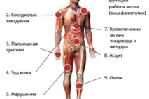 Гепатит Д як передається, симптоми та лікування гепатиту