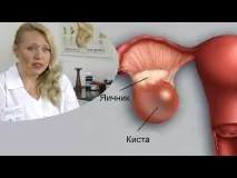 Де у людини знаходиться підшлункова залоза і які підшлункова залоза де знаходиться і як людини