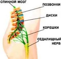 Де знаходиться сідничний нерв як правильно визначити запалення знаходиться