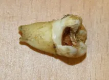 наслідки