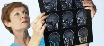 Серозний менінгіт у дорослих симптоми ознаки та наслідки менінгіт