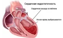 хронічній