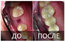 стоматології