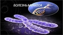 Синдром «дерева» та інші дивні хвороби людства синдром