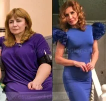 Підтяжка грудей Ірини Агібалової грудей