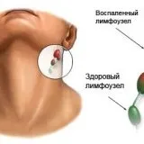 правилно