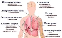 Ознаки лейкозу крові у дорослих та дітей ознаки