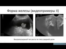 Простата Рекс - ефективний засіб при профілактиці та лікуванні простатиту засіб