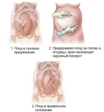 тазового
