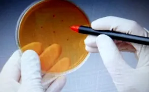 означає аналіз