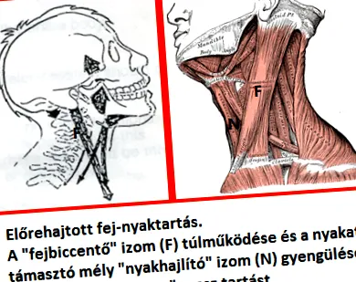 мускулите разтягане
