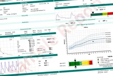 тромботичен център