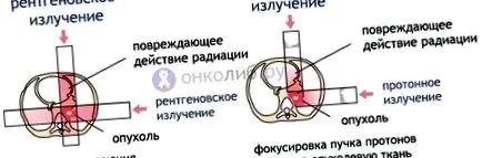 мехур деформация