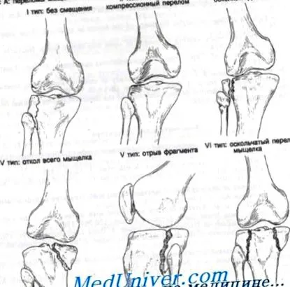chiropractor nivelul