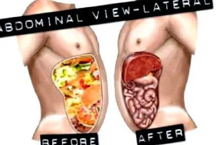 detoxifiere colonului