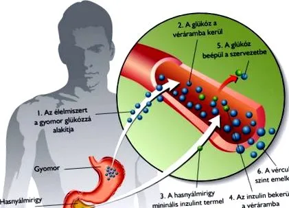 diabet producătoare insulină
