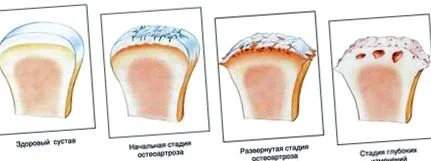разрушаването спрем