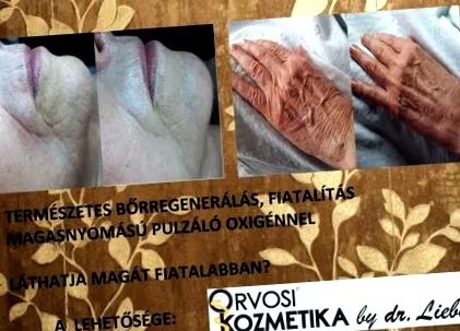 безпліддя безпліддя