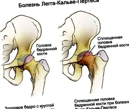 глезена изглежда