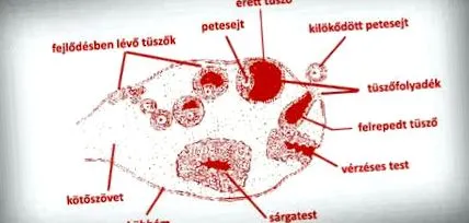 контрацепція контрацепція