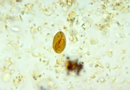 кісти Giardia duodenalis
