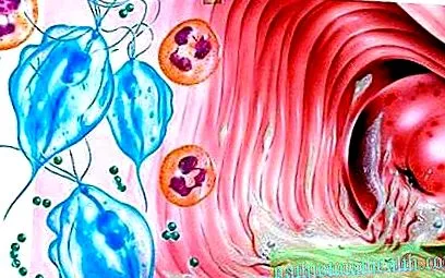 трихомонадата Trichomonas vaginalis