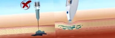 utilizarea utilizarea