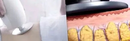 tampoane spune-ți