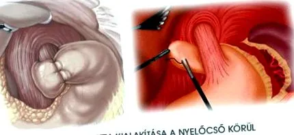 chirurgie funcționează