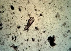 demodex козметика