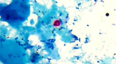giardia giardia