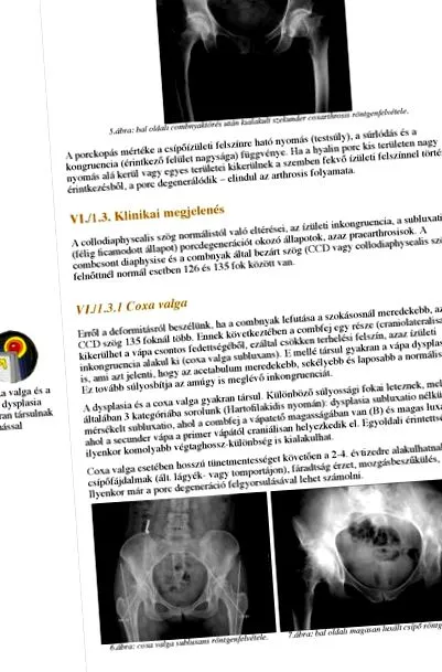 inflamației simptome