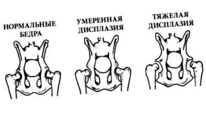 тазобедрен тазобедрен