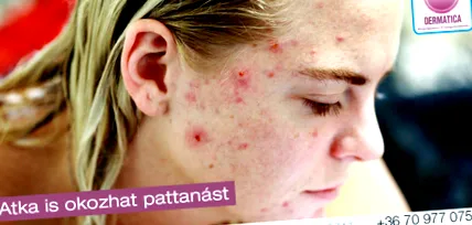 лечение паразити рязан