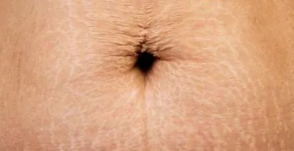 amestec