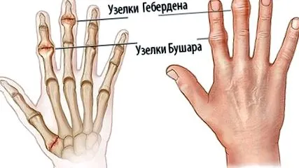 ставите ставите