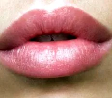 acid hialuronic acid hialuronic