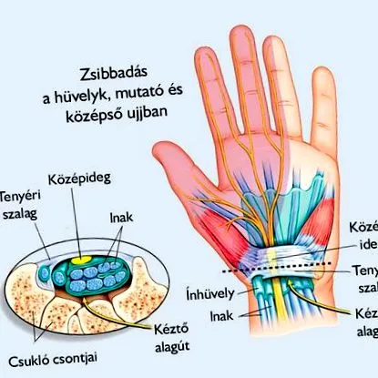 оніміння симптоми