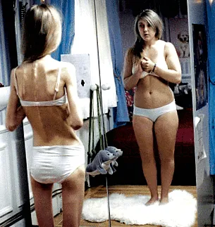 anorexic