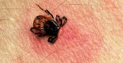 lyme