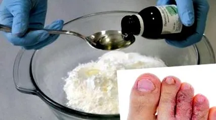 uleiului combinat