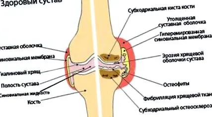 ступінь