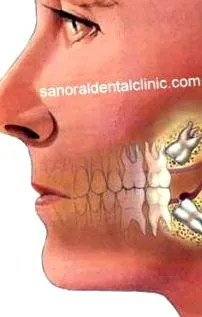 sanoral teeth