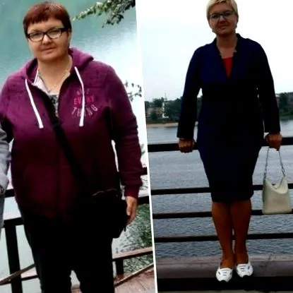 имплантация цена