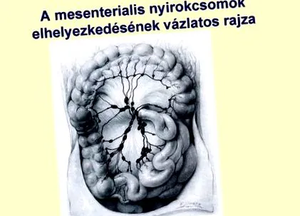 възли възли