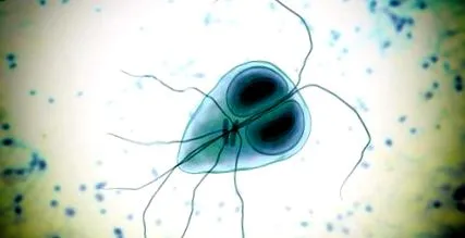 giardiasis giardiasis