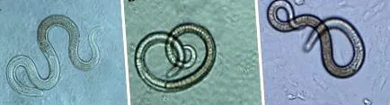 трихінела trichinella