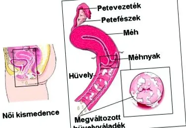 уикипедия лоши