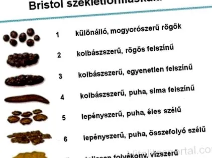 синдром раздразнените